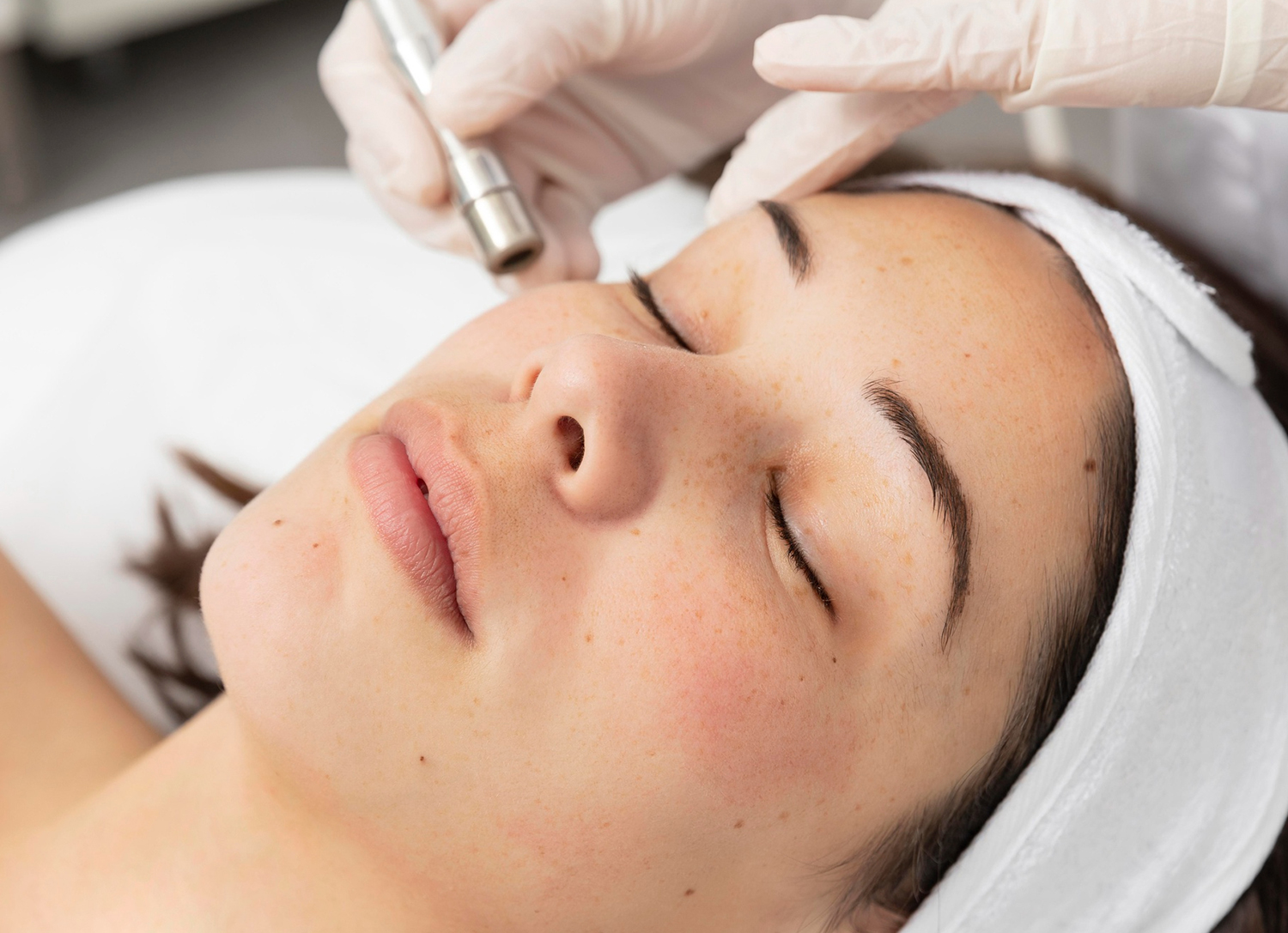 Dermapen