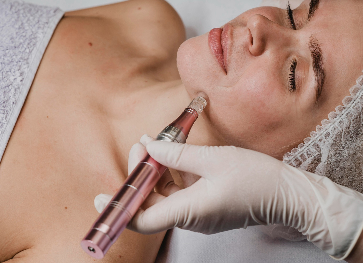 mesotherapy